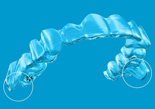 Dental implant